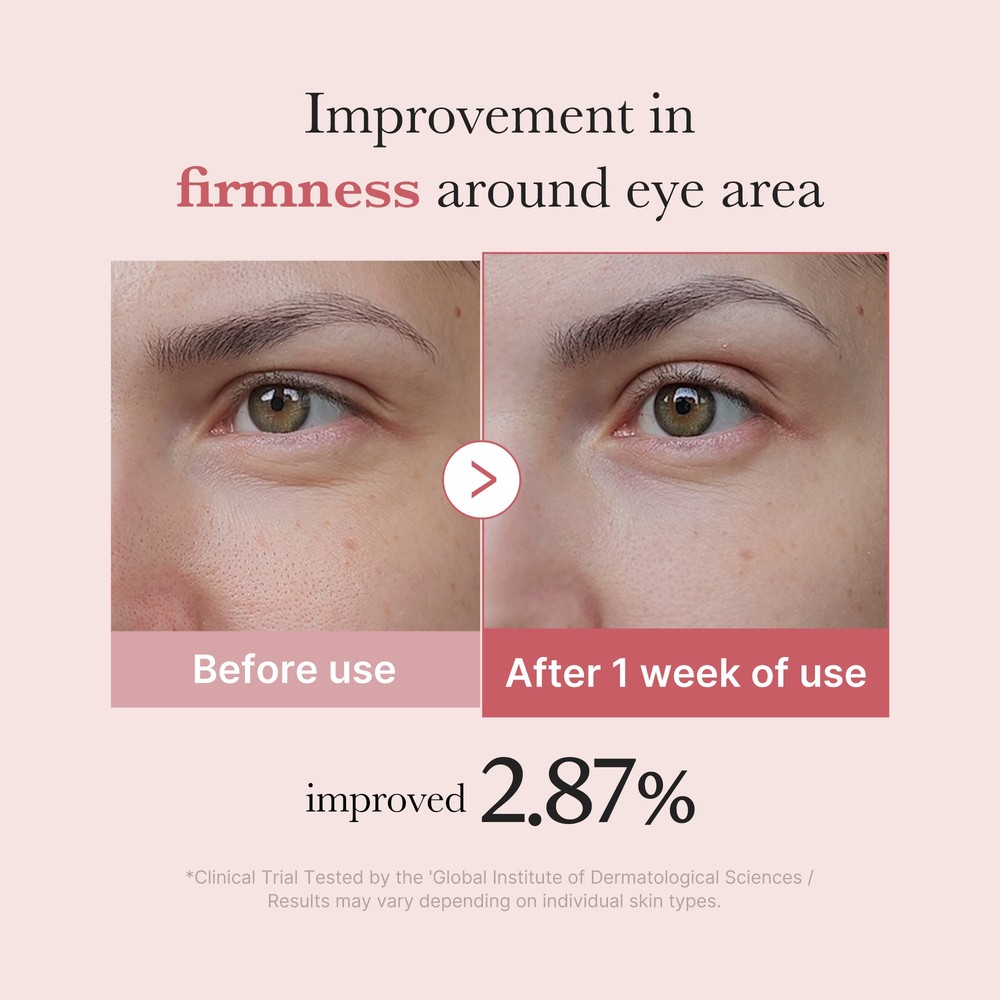Medicube PDRN Pink Peptide Eye Cream 30 ml – øyekrem