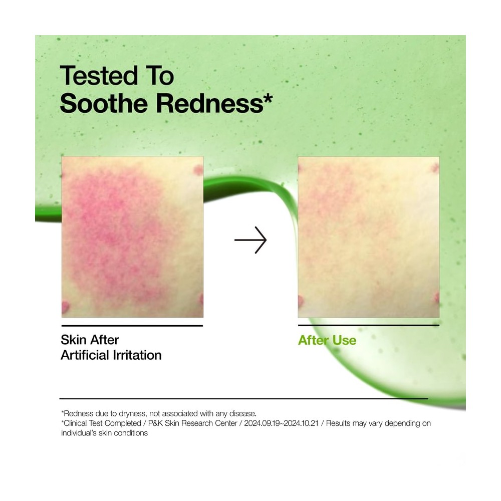 Anua Azelaic Acid 10 Hyaluron Redness Soothing Serum 30ml
