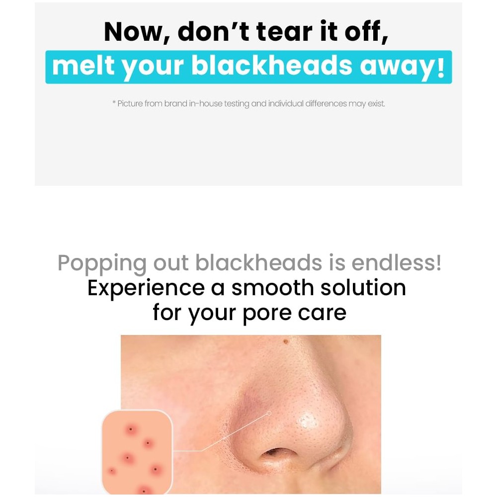 ILSO Natural Mild Clear Nose Pack 5 stk