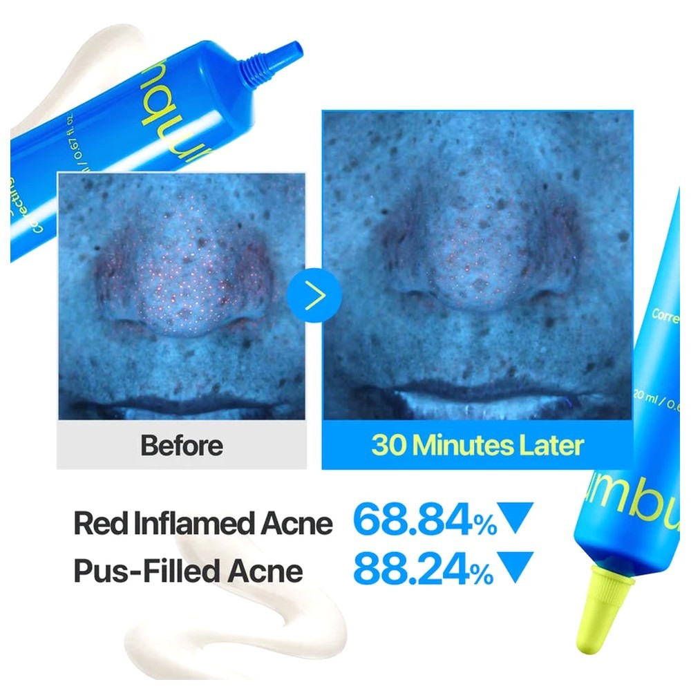 Numbuzin Zero Blemish 3X Spot Correcting Cream 20 ml