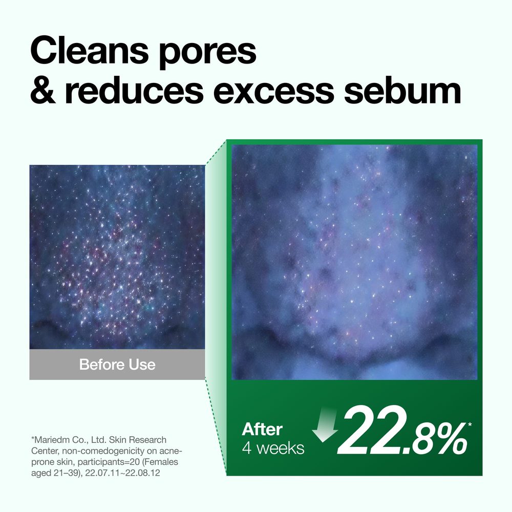 Anua Heartleaf Pore Control Cleansing Oil 200 ml – før og etter