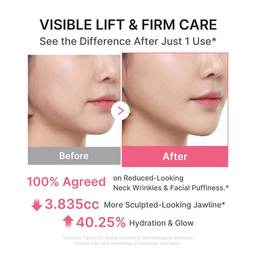 Medicube PDRN Collagen Gua Sha Neck Wrinkle Cream 90 ml – før og etter