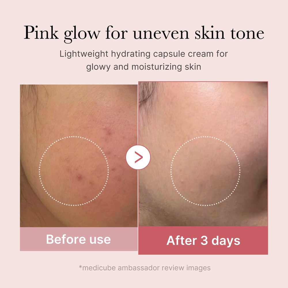 Medicube PDRN Pink Collagen Capsule Cream 55 g – før og etter